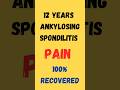 Ankylosing Spondylitis Cured | 100% Real life recovery story