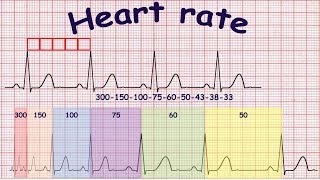 Ecg Basics Methods Of Heart Rate Calculation Youtube