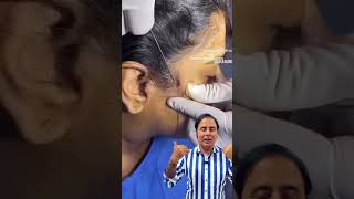 PDO Thread Lift Procedure Explained by Dr. Arun Panda | Facial Plastic Surgeon in Navi Mumbai