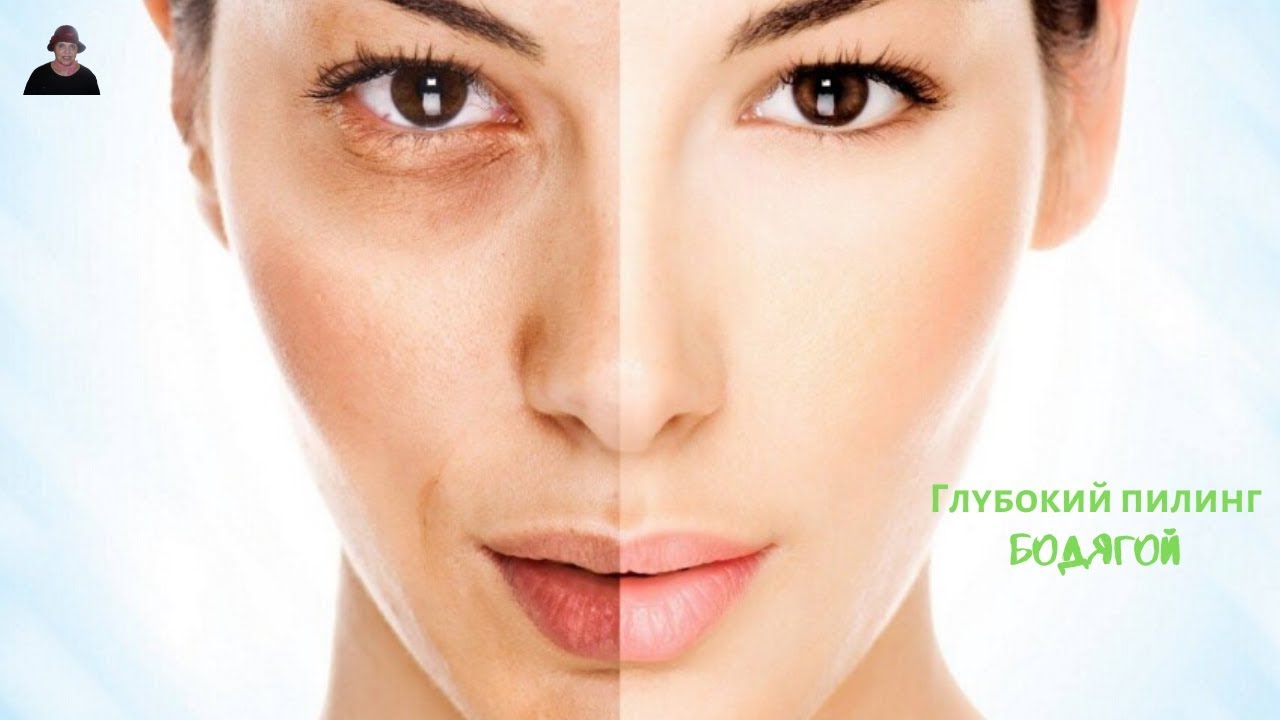 Раскрыт секрет/ Как СДЕЛАТЬ ГЛУБОКИЙ ПИЛИНГ ЛИЦА БОДЯГОЙ в домашних условиях.