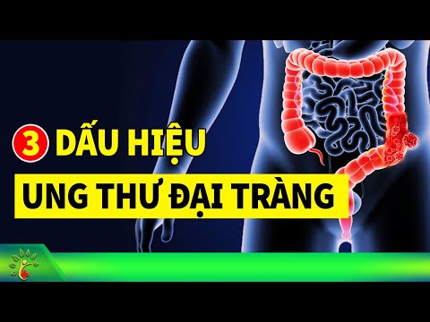 Đi Về Sinh Ra Phân Màu Xanh Lá Cây - Đi vệ sinh xong có dấu hiệu này KHÁM NGAY kẻo ung thư đại tràng | Sống Khỏe Sống Tốt