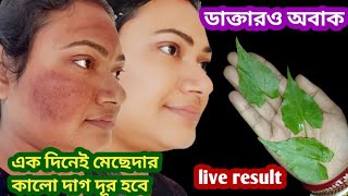 Onalar bilan rus porno tomosha qiling