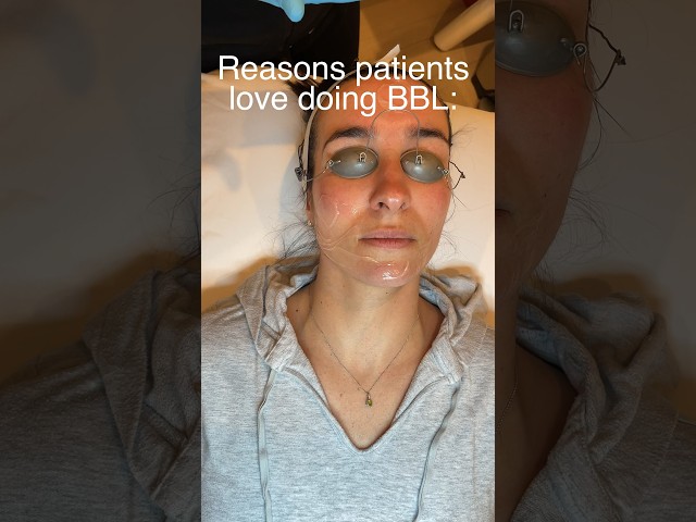 Reasons Patients Love Doing BBL #skincare #beauty #facecontouring #antiaging