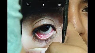 Peruana telefono diagnostica