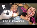 VENEERS VLOG 🦷 + MY EXPERIENCE 🤕