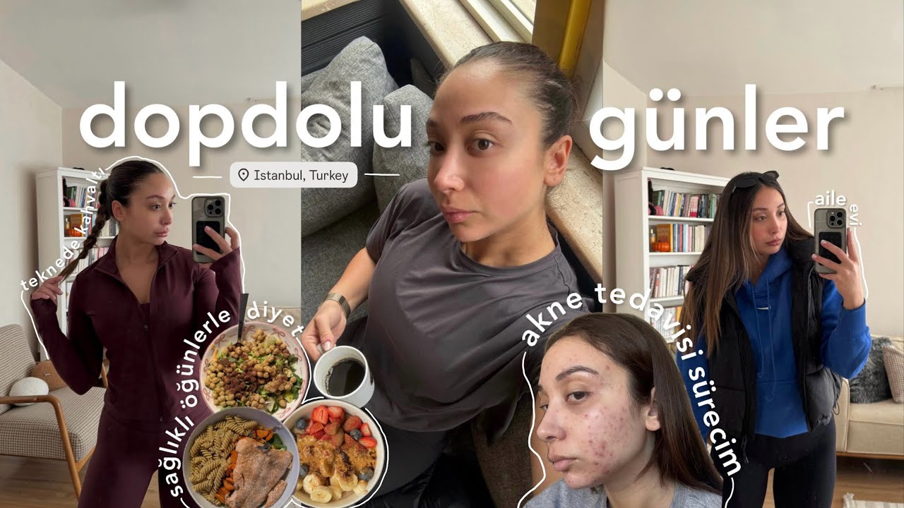 dopdolu günler | akne tedavisi, teknede kahvaltı, aile evi