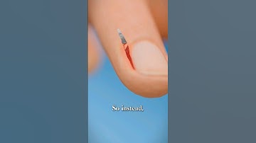 How to Properly Remove Hangnails 😱 #shorts
