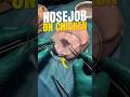 WHY DO PLASTIC SURGEONS PRACTICE ON CHICKEN  YOURFACTSBUNNY #shorts #viral #trending #youtubeshorts