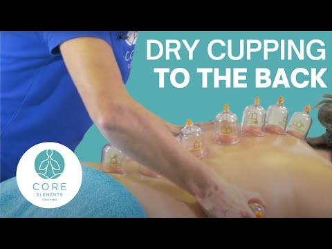 Clinical Dry Cupping