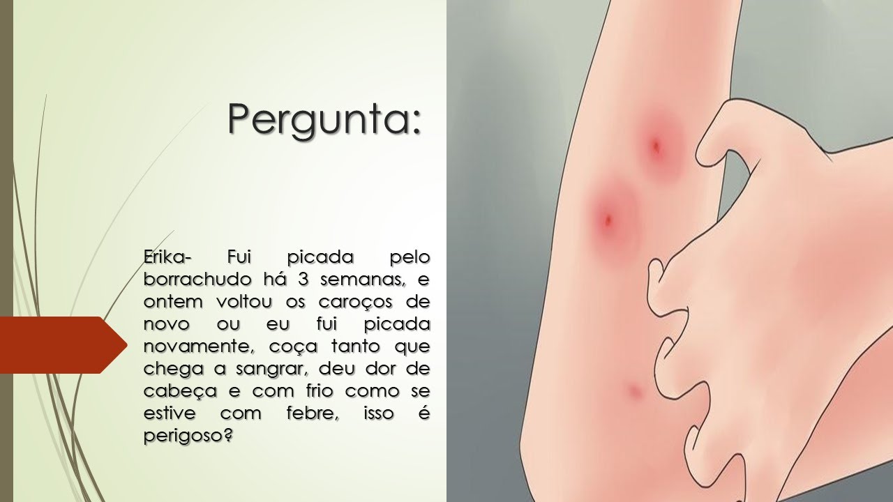 Fui picada pelo borrachudo | Os caroços caçam tanto que chega a sangrar ...