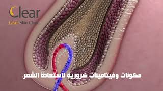 علاج تساقط ومشاكل الشعر