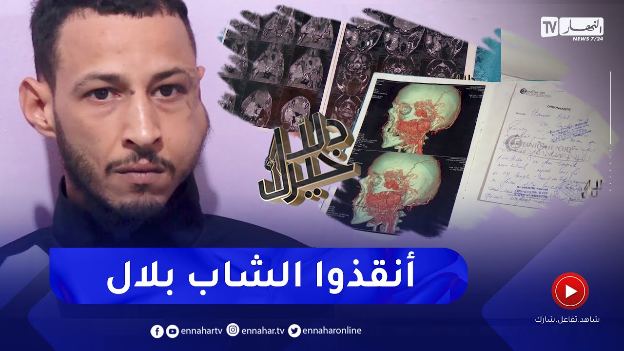 دلال خير: شاب في ربيع العمر أصيب بورم خبيث على مستوى الوجه يطلب منكم المساعدة للعلاج