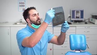 Dentist Studying An X-ray Image Stock Video