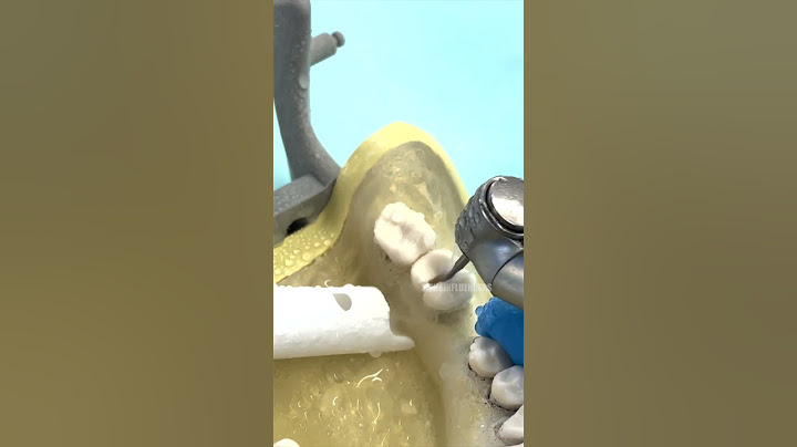 How The Dentist Extracts a Tooth