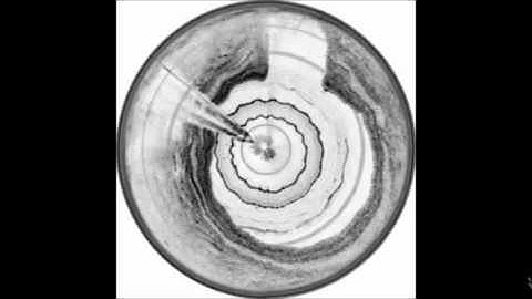 Optics Express : Polarization sensitive optical frequency domain imaging system for endobronchial...