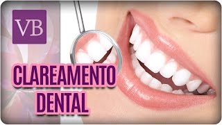 Mitos e Verdades do Clareamento Dental - VocÃª Bonita (25/01/17)