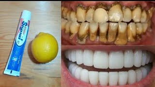 Skin Whitening See Magical Result with natural ingredientsوصفة طبيعية لتبييض الوجه