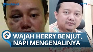 Pendanakan Wajah Herry Wirawan Babak Belur Usai Para Napi Mengenalinya Dan Penjelasan Karutan