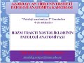 Həzm traktı xəstəliklərinin patologiyası - Mühazirə