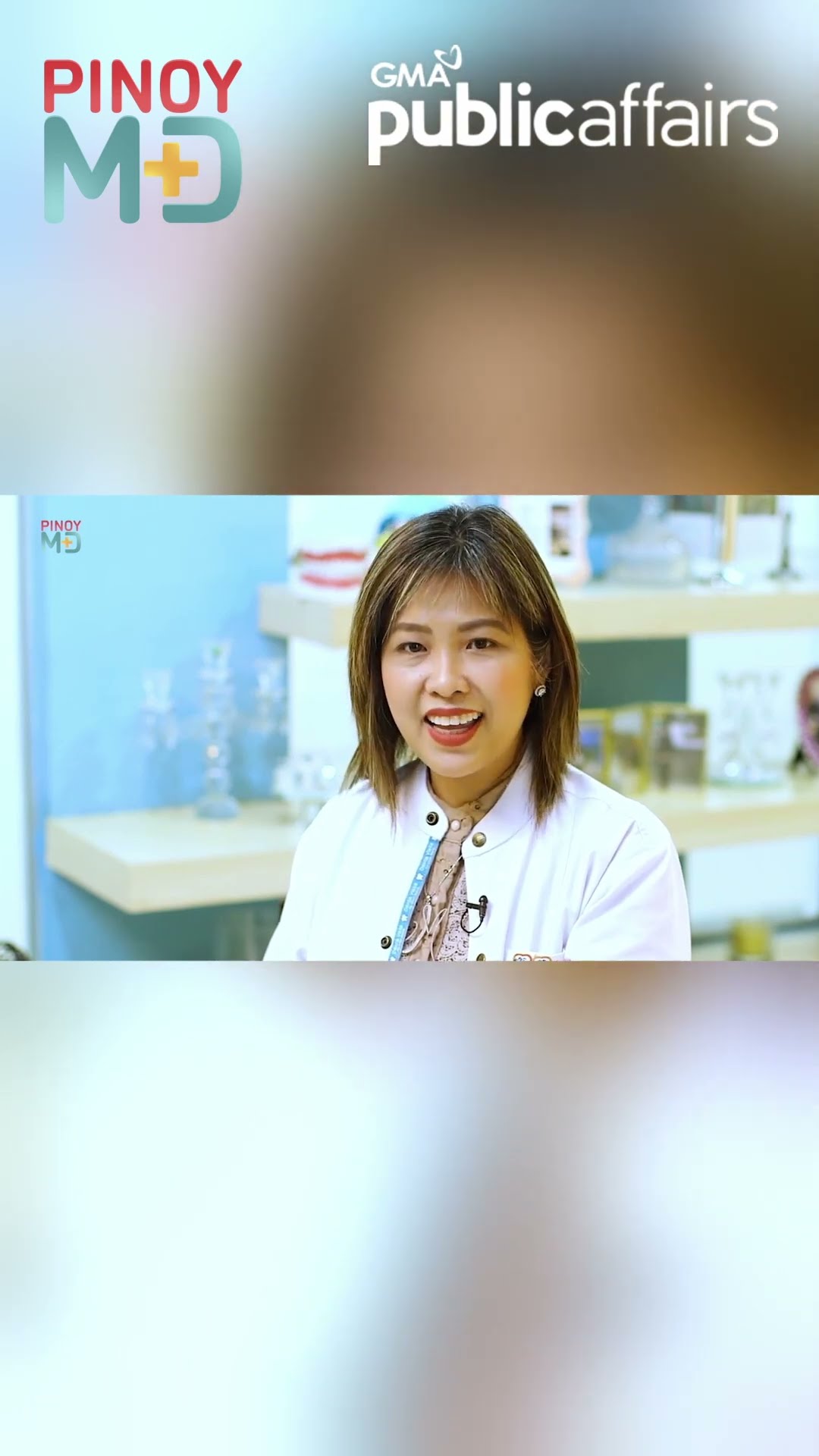 Ano ang tonsil stones? | Pinoy MD