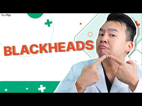 Removing Blackheads: Best x Worst Ways