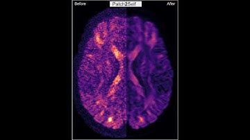 Patch2Self Denoising - Quick tutorial - How to install and use in seconds!