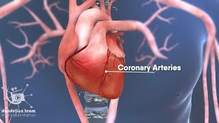 Coronary Angioplasty 3d medical animation  by Dandelion Team