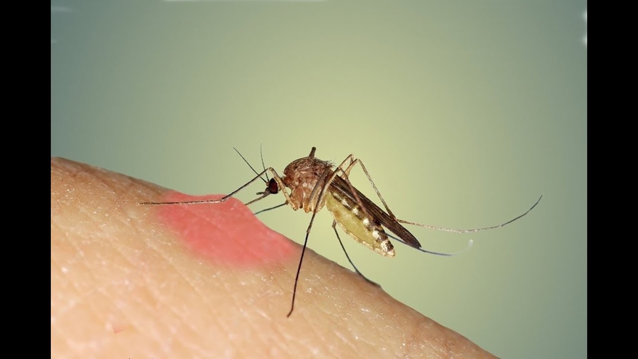 curare Porqué los mosquitos pican mas a algunas personas que a otras
