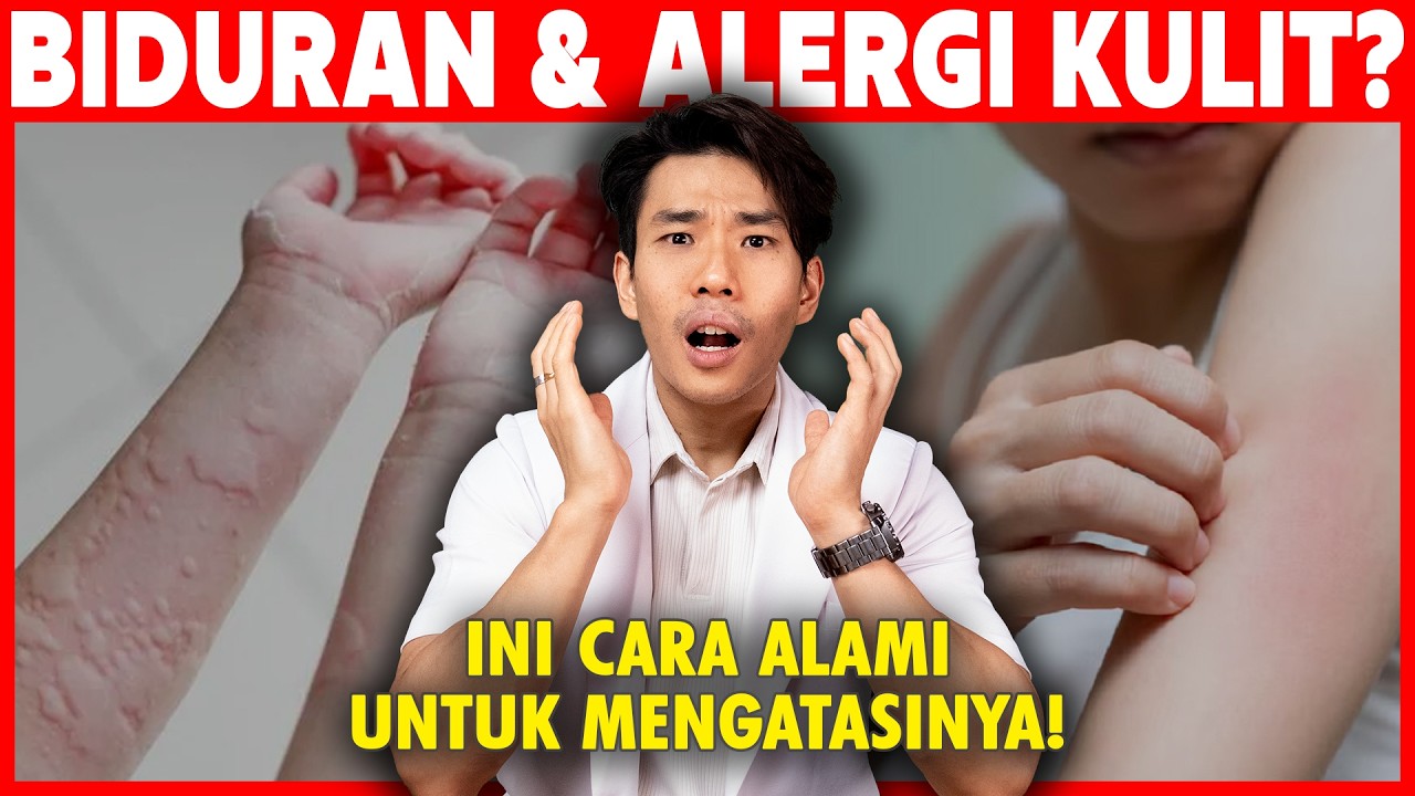Cara Alami Mengatasi Biduran Dan Alergi Kulit