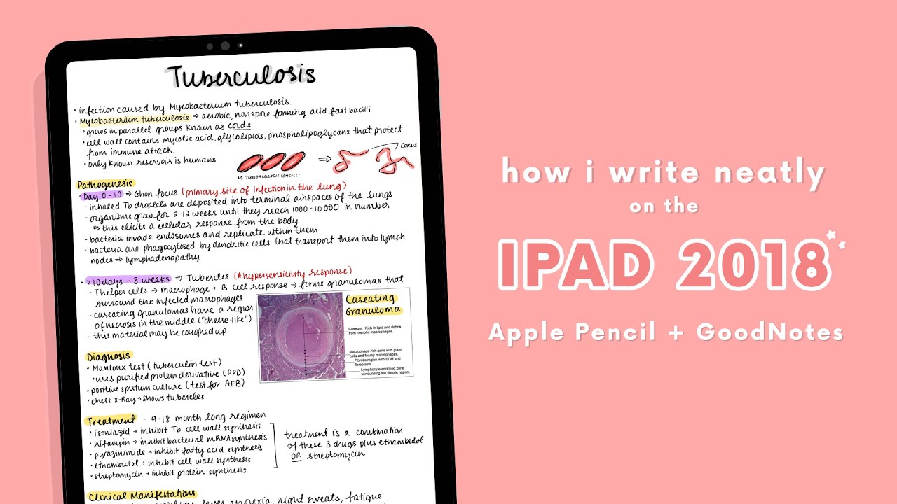 How I Write NEATLY on the iPad (GOODNOTES + APPLE PENCIL) ✏️