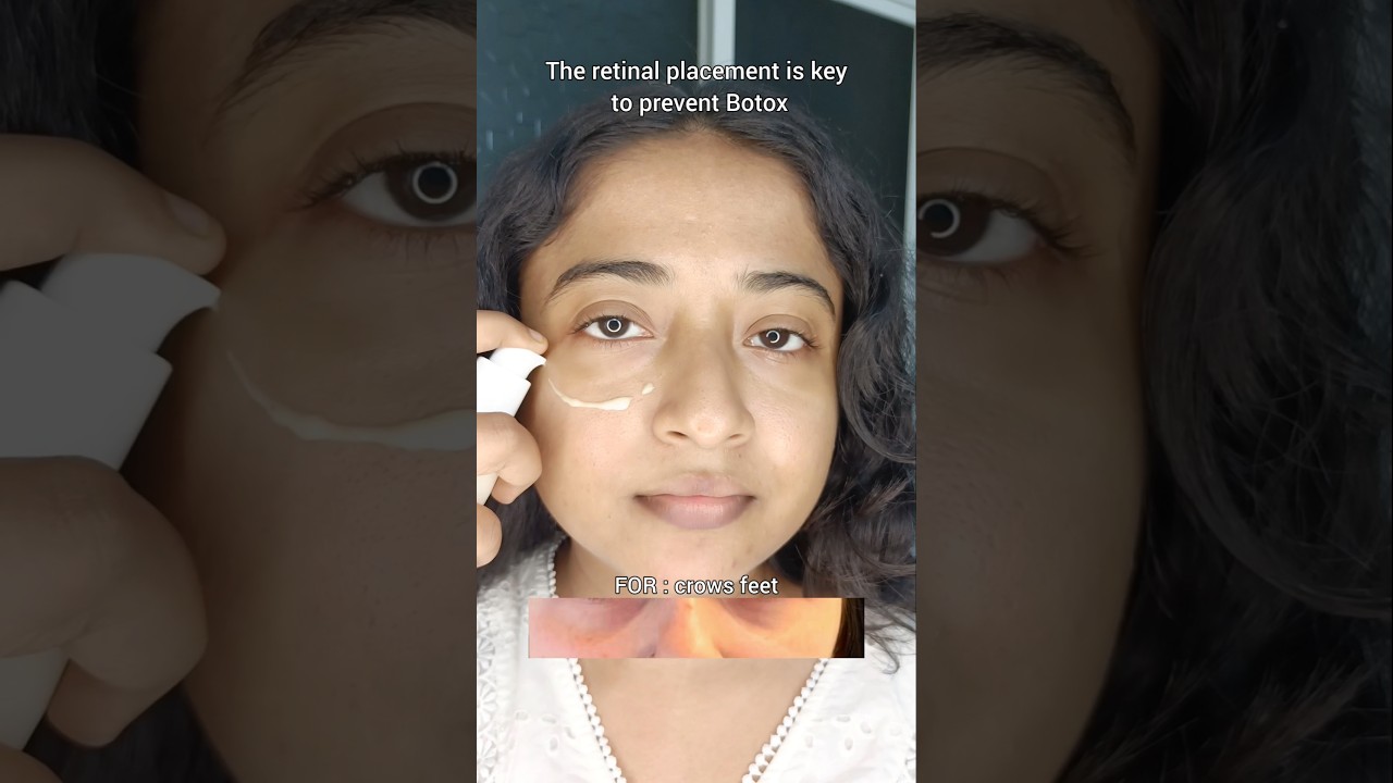 Affordable botox treatment 