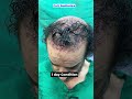 One procedure → Lifetime confidence! #trending #reels #hairtransformation #shorts #best #haircare