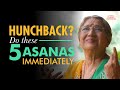 5 Best Asana to Correct Hunchback Posture | Dr. Hansaji Yogendra