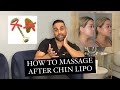 How to massage after chin lipo