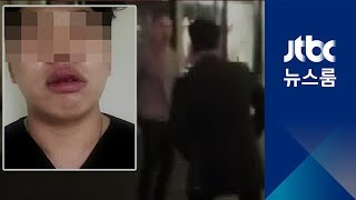 영국서 한국인 유학생 집단폭행…'인종차별' 증오 범죄