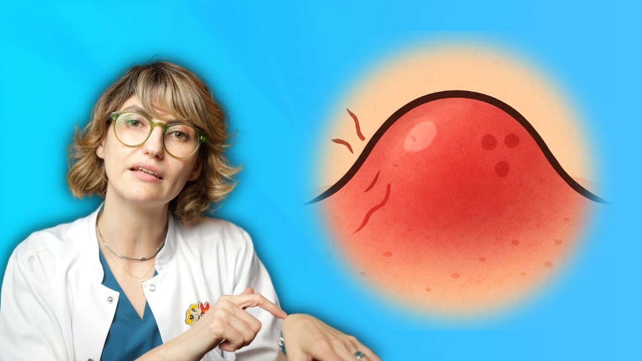 Ce faci când ai un abces?