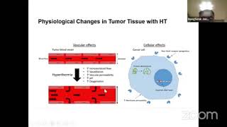Hyperthermia Therapy Using Remission 1°C Device. By Prof. Dr Jang Hong-Seok