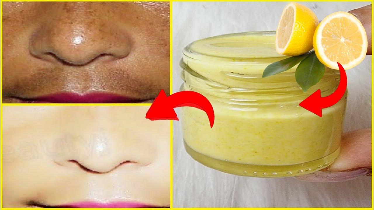 Sihirli Limon Kremi, KIRIIKLIK GDERMEK KOYU LEKELER TEMZLEMEK 10 YA  DAHA GEN GRNMEK N