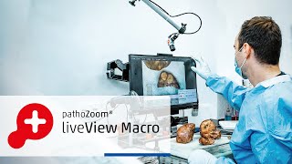 PathoZoom® LiveView Macro: The Smartest Way to Digitize Your Grossing Station