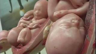 David Esch looks at teen pregnancy in schools Profile