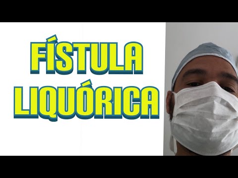 Fístula Liquórica  Espontânea