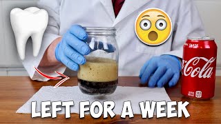 What Happens if You Leave a TOOTH in COKE for a Week (Experiment)