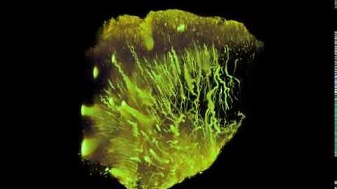 Zooming in on the human fetal brain with iDISCO and mesoSPIM