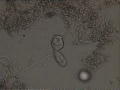 Crawling Ciliate Bugging His Cousin the Stalked Ciliate