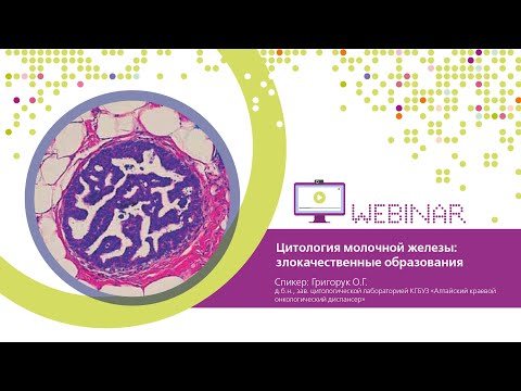 Цитология молочной железы: злокачественные  образования