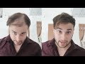Thick Looking Hair In Seconds - No More Thinning Hair - Transformation 2019