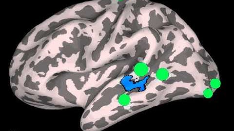 GPS: Granger causation into the left posterior STG