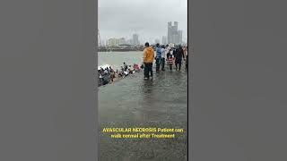 Patient can walk normal after AVN Treatment by Dr. Vijay Prakash 7007968664