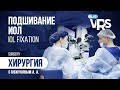 Подшивание ИОЛ. Хирургия с Кожуховым А. А. | IOL fixation.