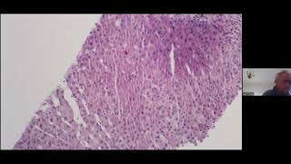 Pathology Case Presentations -  Prof Martin Hale